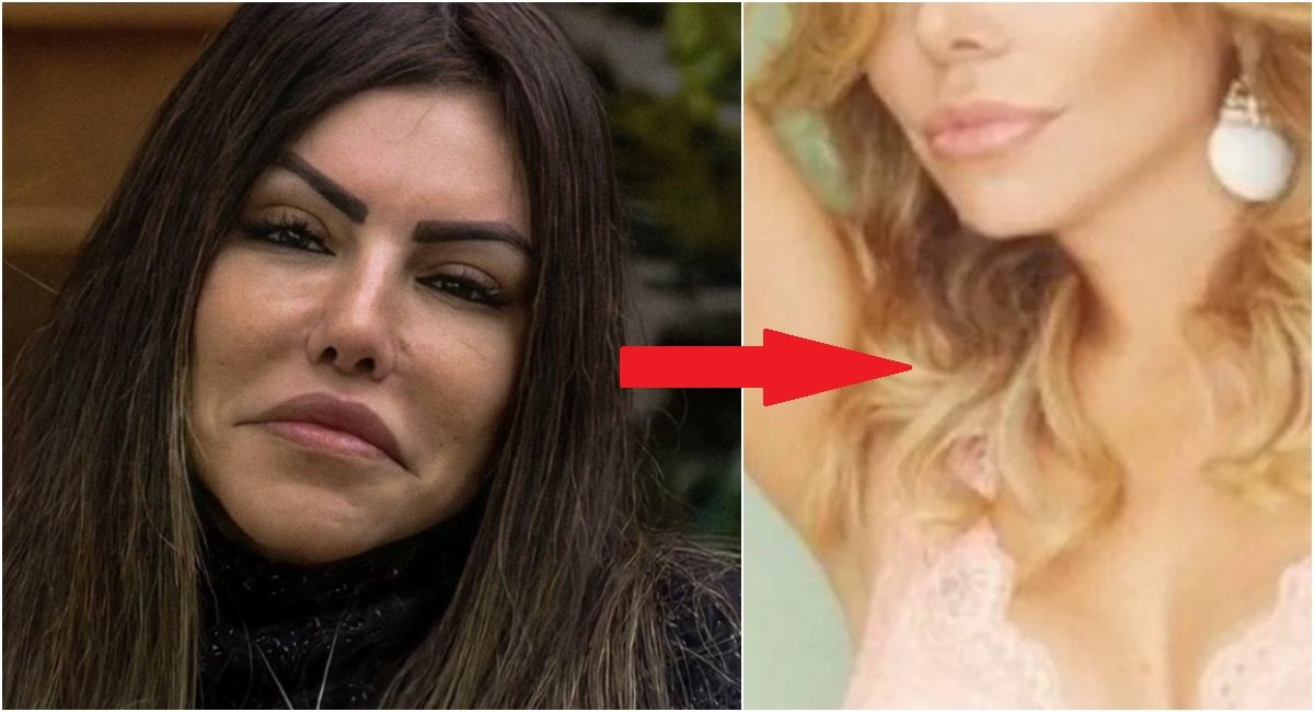 A Fazenda Antes E Depois Do Rosto De Liziane Gutierrez Vaza E Choca