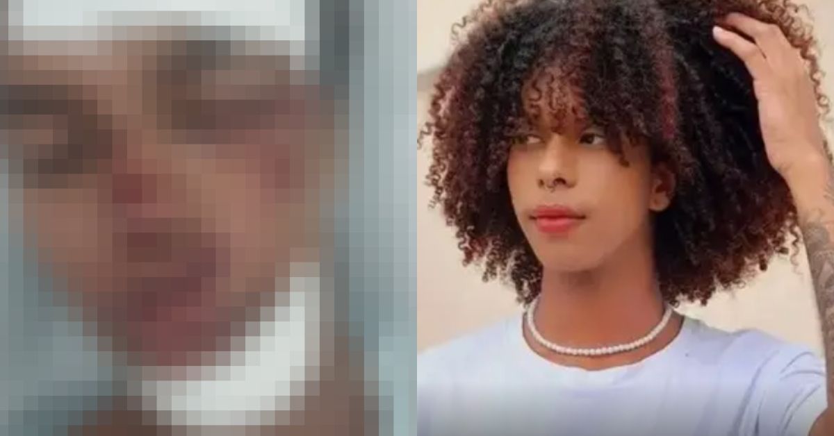 Influenciador baiano fica em estado grave após tentativa de assalto que terminou com agressões de capacete: 'rosto desfigurado' 31 FN+