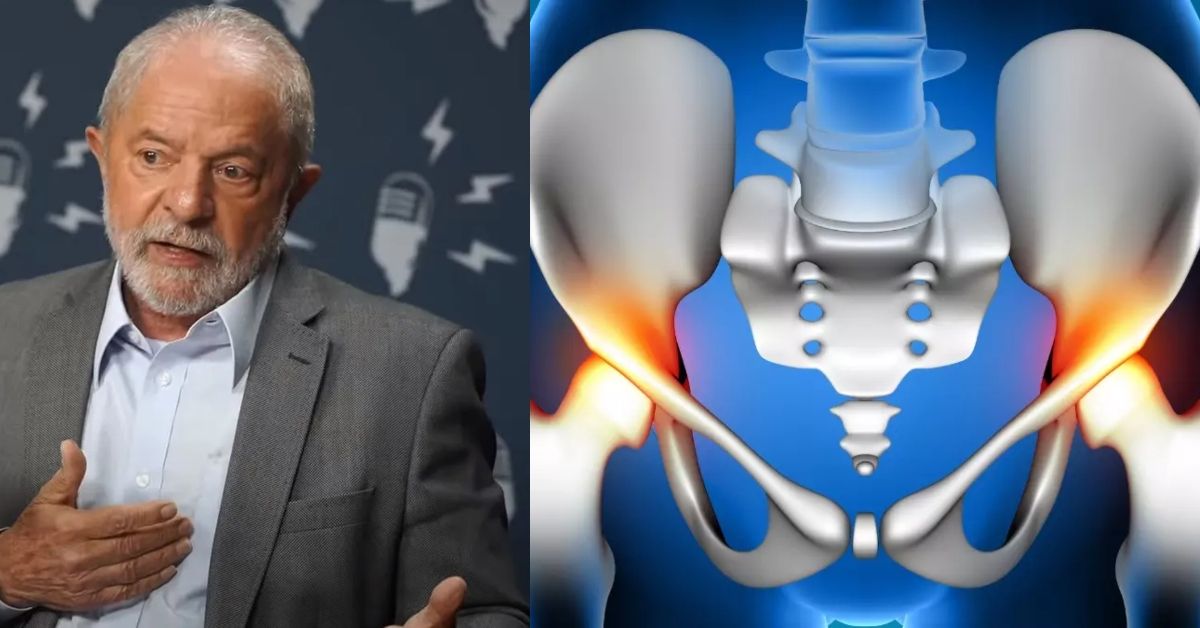 Equipe médica atualiza estado de saúde do presidente Lula após cirurgia no quadril 31 FN+