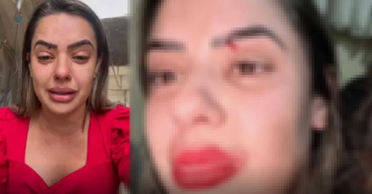 Repórter da Band denuncia ex por agressões: 'sangrou muito' 31 FN+