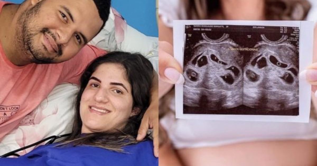 Mãe brasileira dá à luz a sêxtuplos em parto de apenas 10 minutos 31 FN+