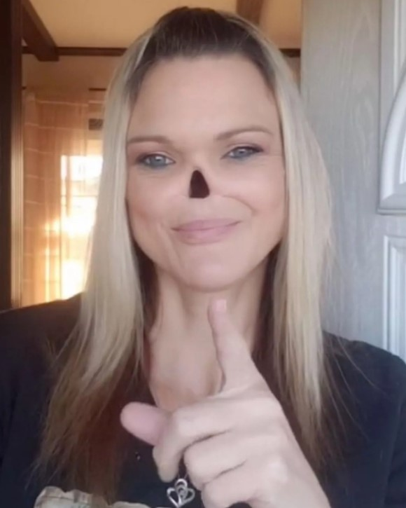 Mulher que teve o nariz retirado por conta de câncer expõe dificuldades: “Cuidar” 34 image 7.png