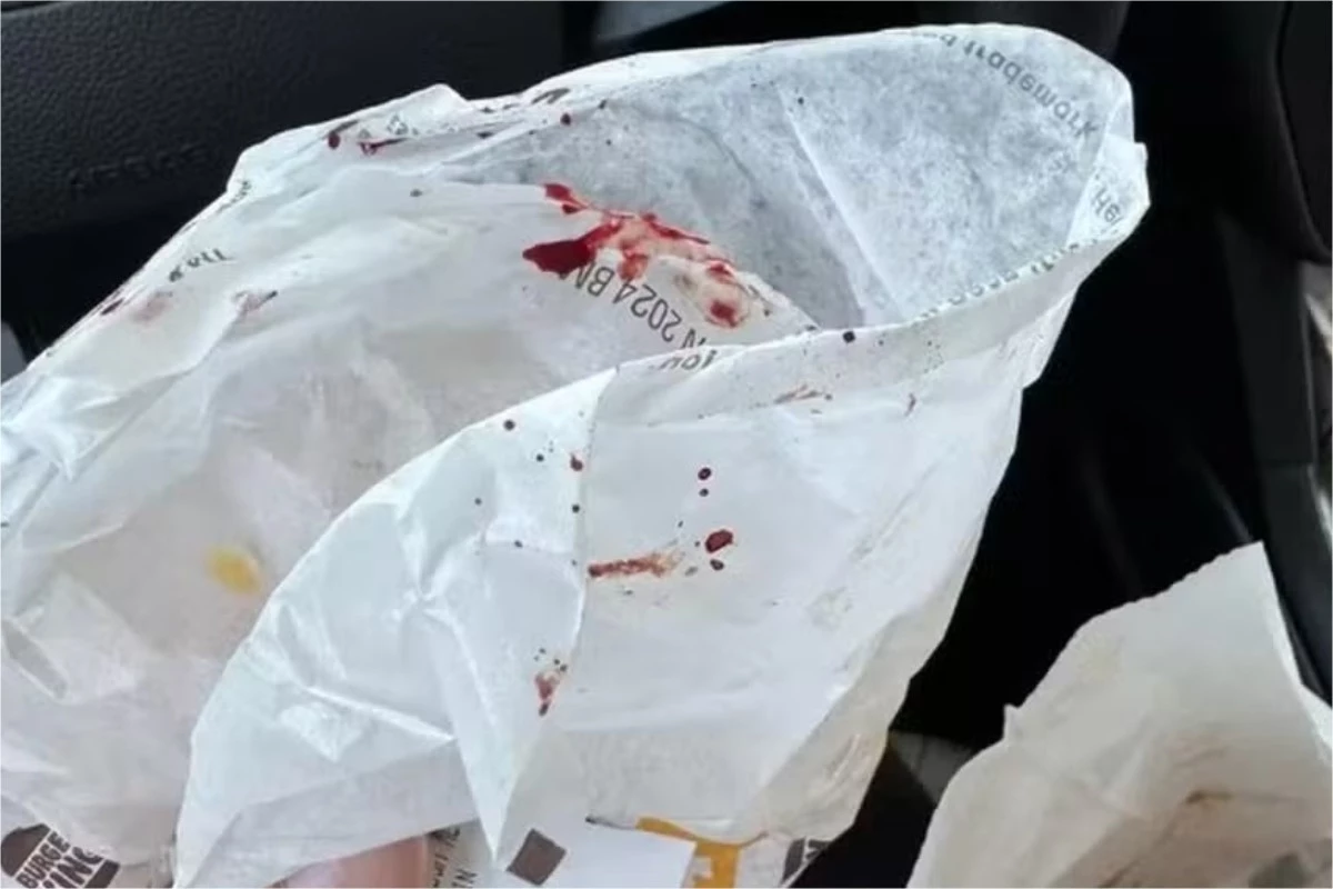 ‘Não quero ketchup’: mulher recebe lanche com sangue e fica revoltada com o que vê 31 1News Brasil