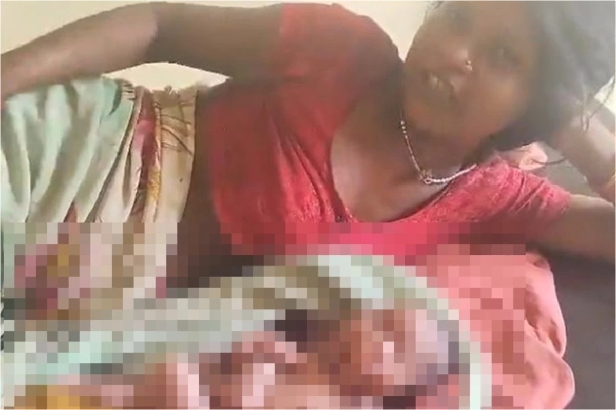 Bebê nasce com duas cabeças, quatro braços e quatro pernas; médicos ficaram perplexos 31 1News Brasil