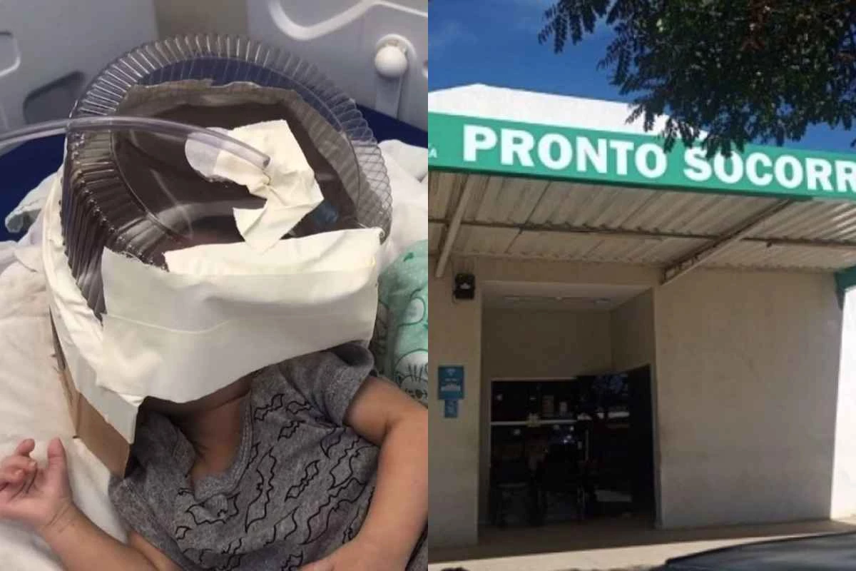 Bebê que teve embalagem de bolo improvisada como respirador em hospital não suporta, e o pior acontece 31 1News Brasil