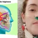 Desistiu de viver Neuralgia do trigemeo doenca da influenciadora.webp