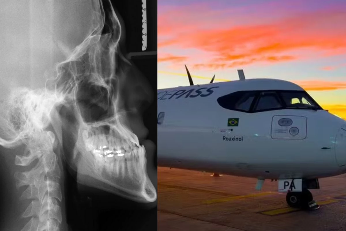 Acidente aéreo de Vinhedo: IML divulga laudo com causa do óbito das vítimas; entenda como é provocada 31 1News Brasil