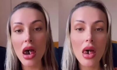 Andressa Urach Toma Medida Desesperada Apos Inflamacao na Lingua Cortada.webp.jpeg