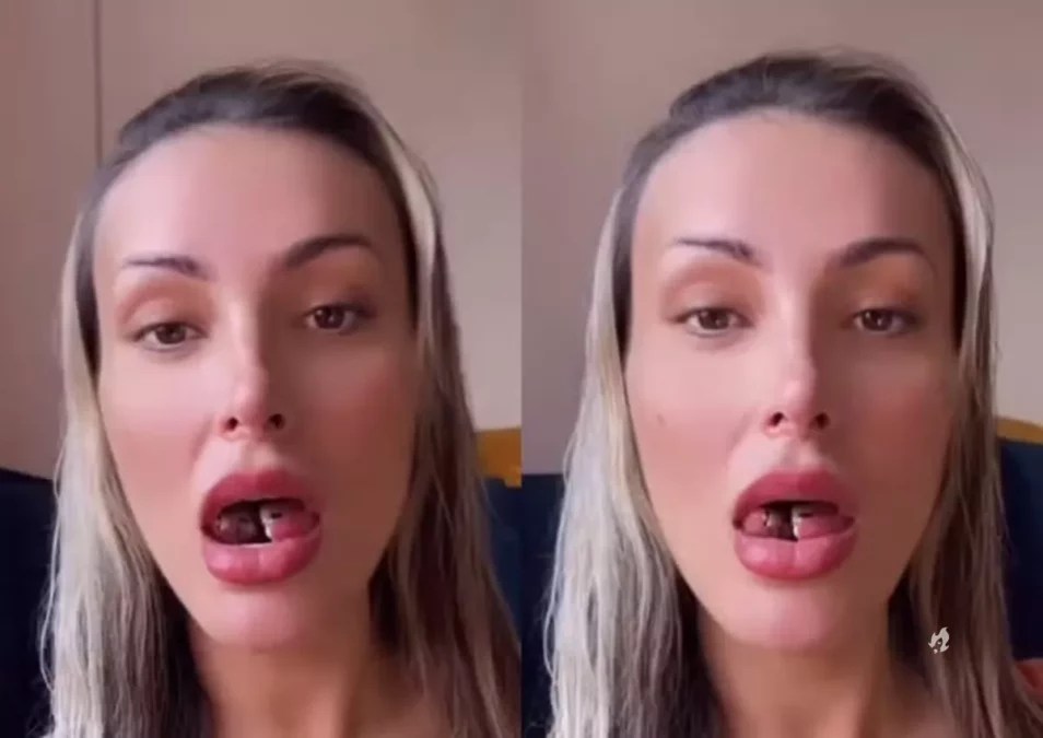 Andressa Urach toma medida desesperada após língua cortada inflamar 31 Andressa Urach toma medida desesperada apos lingua cortada inflamar.webp.jpeg