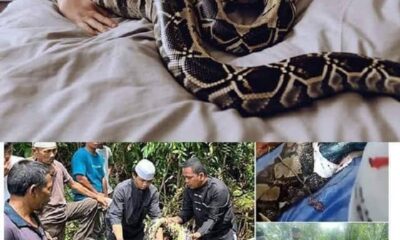Mulher Dorme com Sua Cobra Piton Ate Veterinario Mostrar Ultrassom.jpg