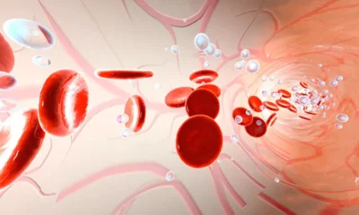 A fruta que remove acucar do sangue e contribui.webp