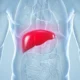 Cancer de figado especialistas indicam sinal facil de ser percebido.webp