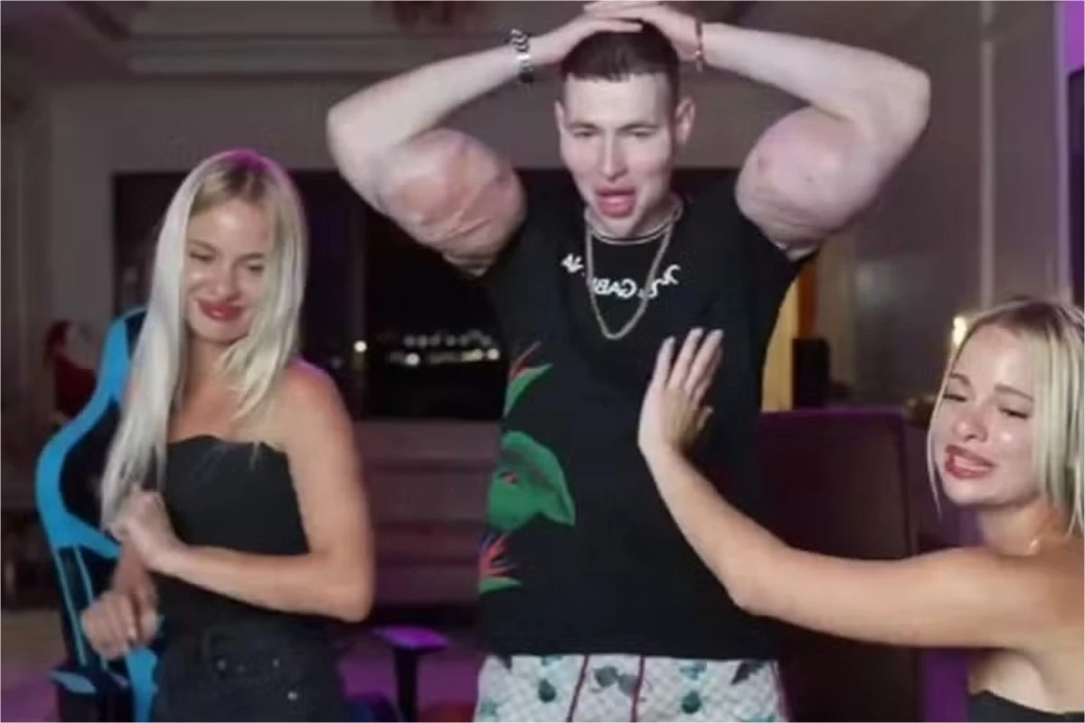 ‘Popeye russo’ aparece entre modelos e ganha conselho inusitado dos fãs 31 1News Brasil