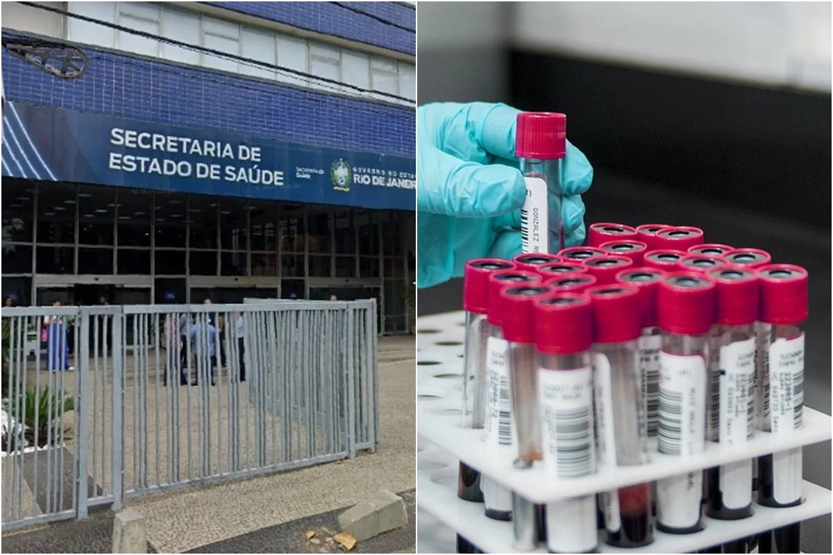 Falso negativo expõe 6 pacientes que receberam órgãos no RJ ao HIV 31 1News Brasil