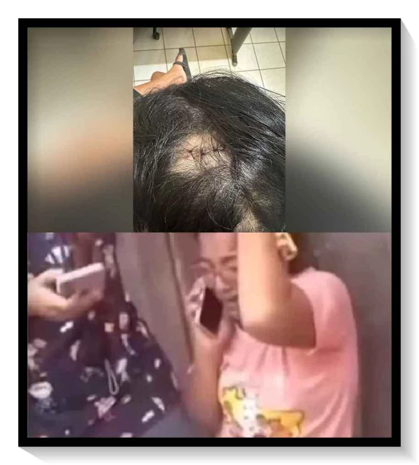 enfermeira e atingida com golpe de facao na cabeca em