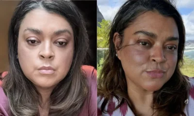 Medico orienta cuidados com Preta Gil apos operacao ‘nao.webp