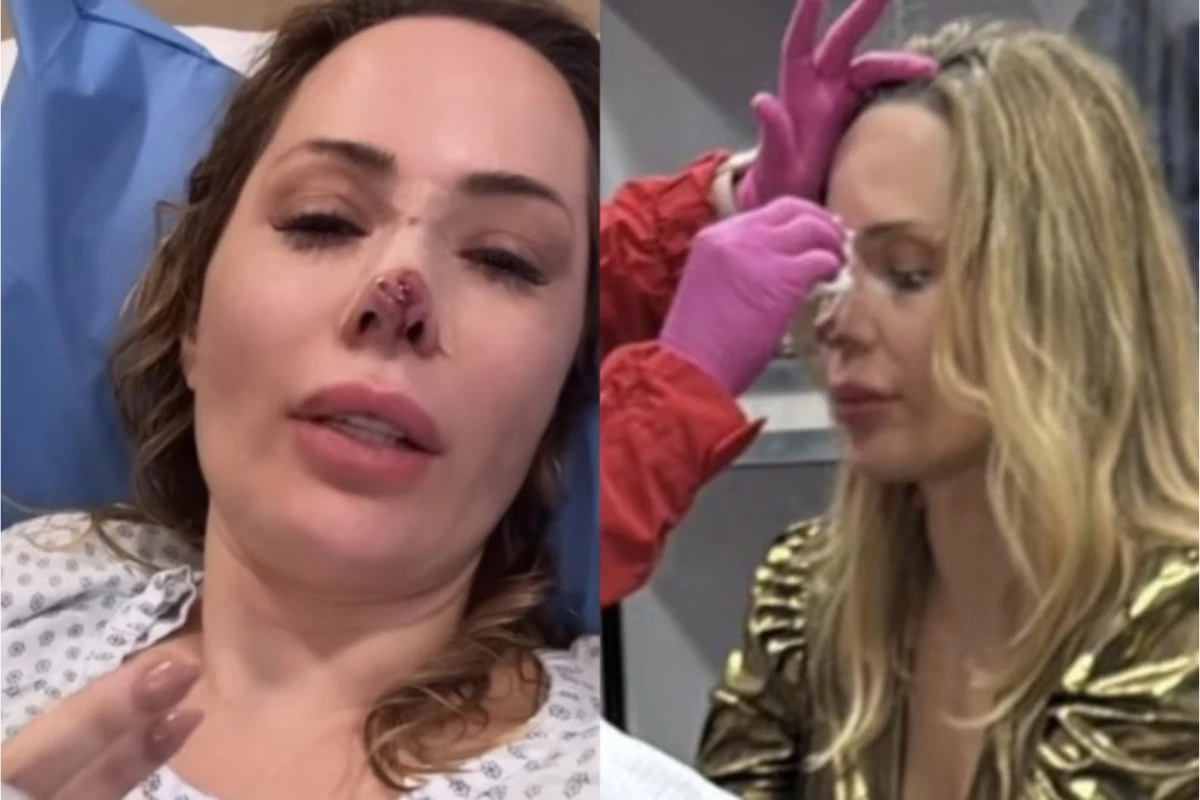 Cachorro morde rosto de influenciadora brasileira durante viagem, e vítima perde parte do nariz: 'me atacou violentamente' 31 1News Brasil
