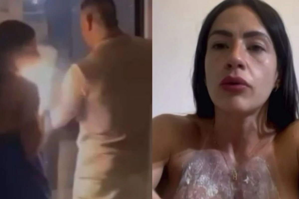 'ter pegado fogo no meu rosto' 31 1News Brasil