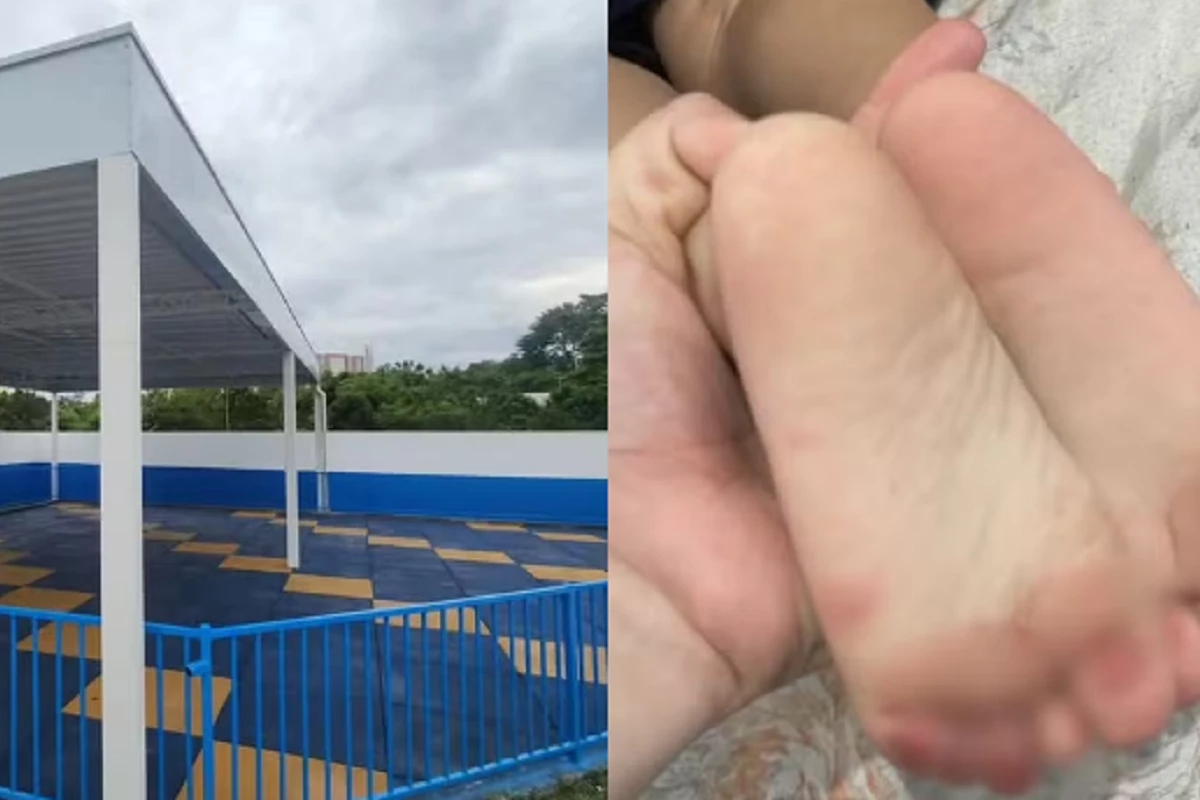 Bebê sofre acidente em escola; ele sofreu queimadura de 1º grau nos pés ao pisar em chão quente 31 1News Brasil