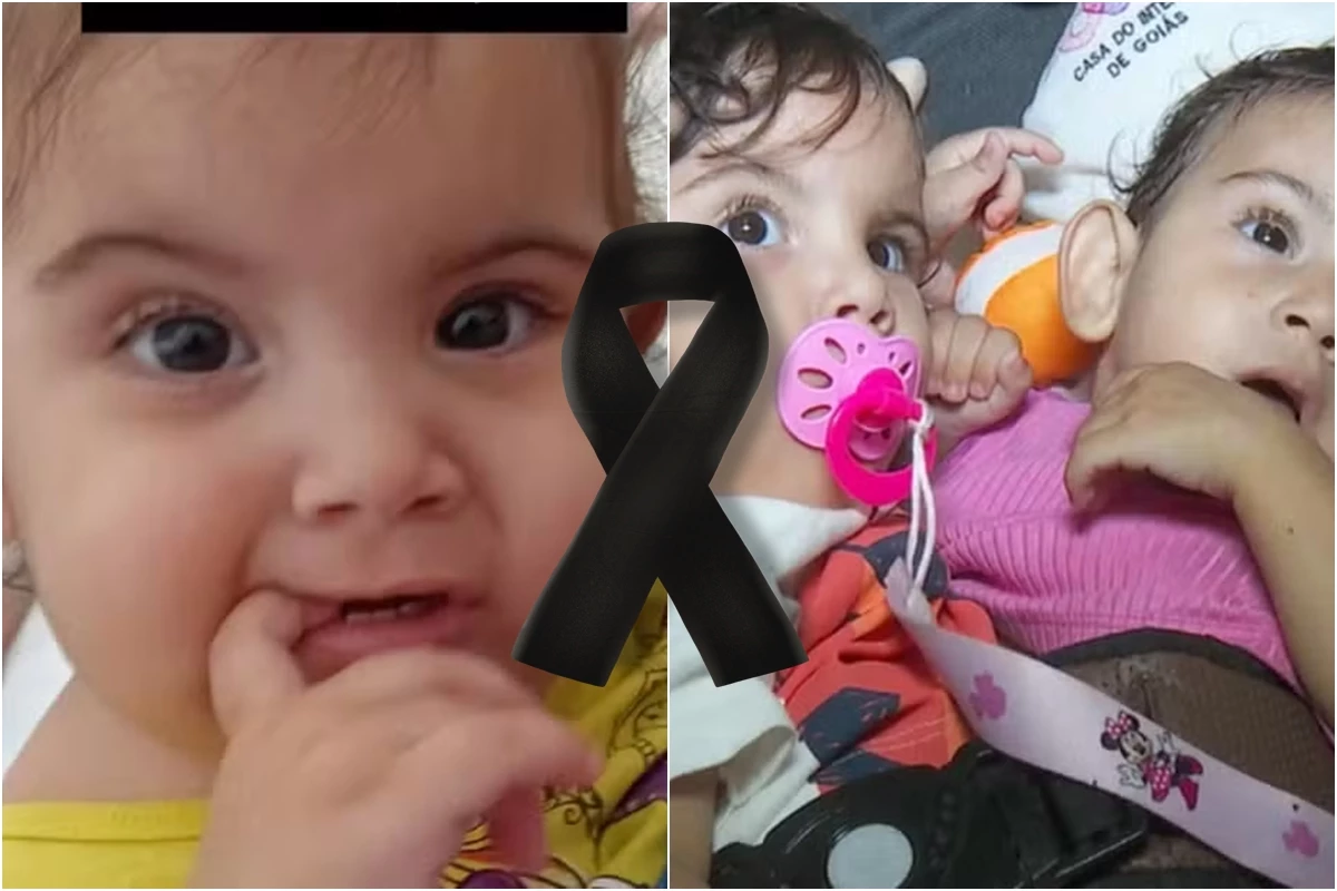 Pais lamentam morte de uma das filhas siamesas, separadas em hospital de Goiás, e web reage: 'Pior notícia' 34 1News Brasil