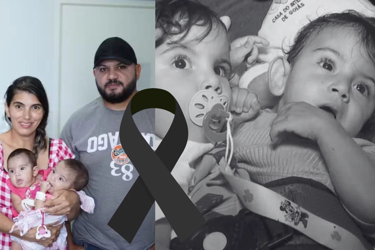 Antes da cirurgia que deu errado, essa foi a mensagem de fé e esperança do pai das gêmeas siamesas 31 1News Brasil