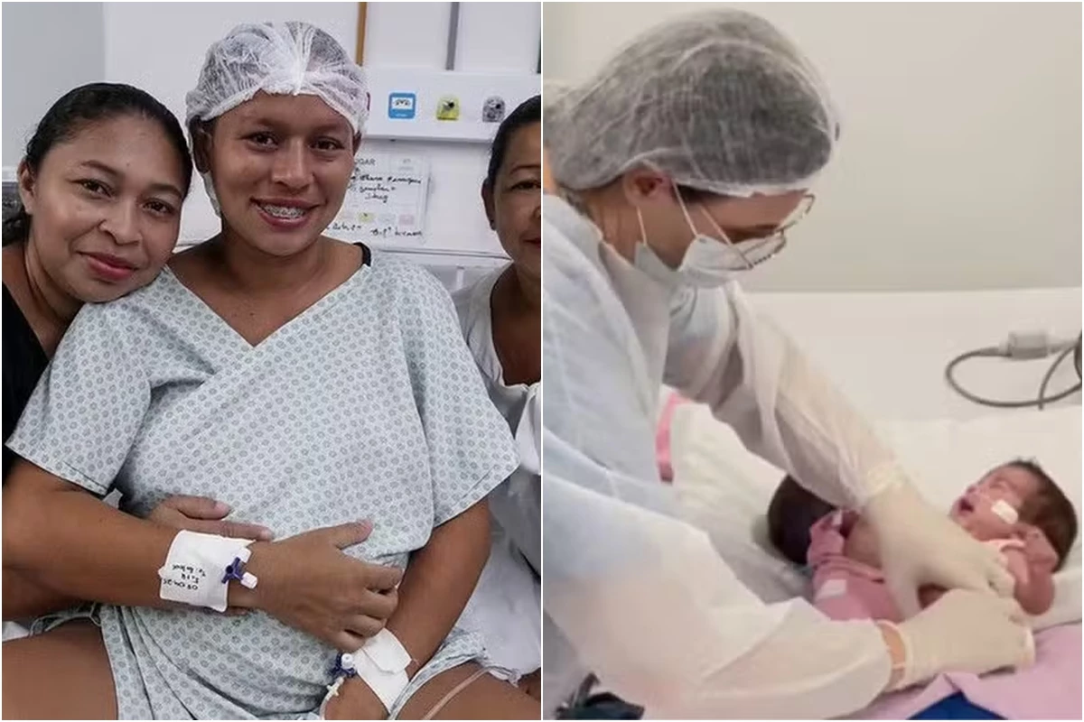Após médicos separarem gêmeas siamesas, estado de saúde é revelado e mãe pede oração 31 1News Brasil