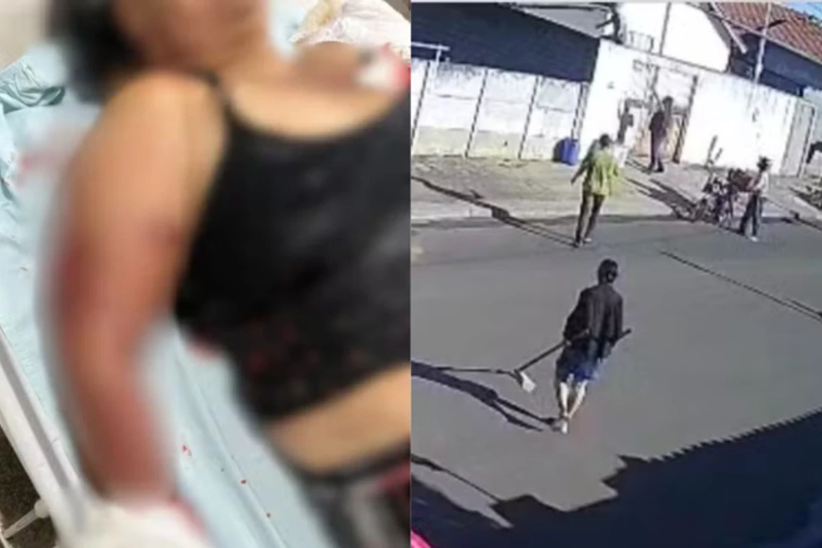 Avó de 46 anos salva neta de ataque de pit bull em Goiás e desmaia após ser gravemente ferida 31 1News Brasil