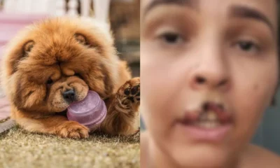 Cachorro arranca pedaco da boca de tutora e e submetido.webp