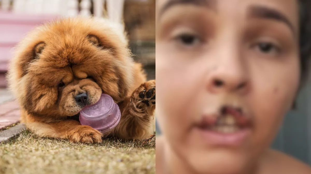 Cachorro arranca pedaço da boca de tutora e é submetido à eutanásia em RO 30 Cachorro arranca pedaco da boca de tutora e e submetido.webp