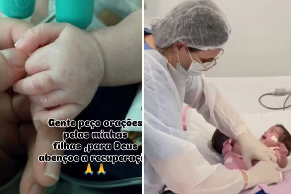 Mãe de gêmeas siamesas desabafa em momento decisivo de recuperação e faz súplica: 'Peço orações...' 31 1News Brasil