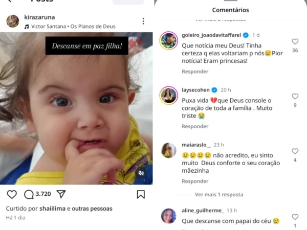 Pais lamentam morte de uma das filhas siamesas separadas em
