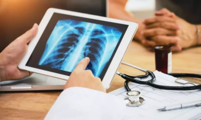 Pais teve mais de 31 mil casos suspeitos de.webp