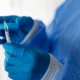 Rio retoma vacinacao contra Covid 19 com nova dose para.webp