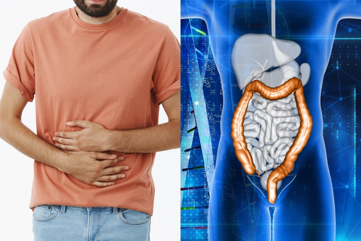 Homem que foi diagnosticado com estresse após dor de estômago falece, dias depois, de câncer no intestino 31 1News Brasil