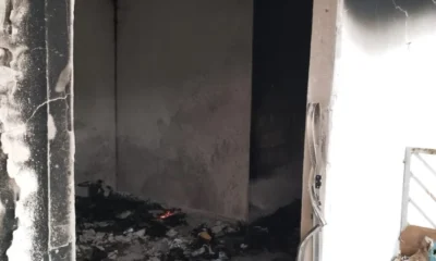 Mulher ferida durante incendio dentro de casa esta internada.webp