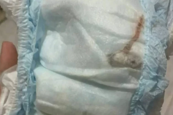 Produto infantil vira caso policial apos descoberta assustadora feita por